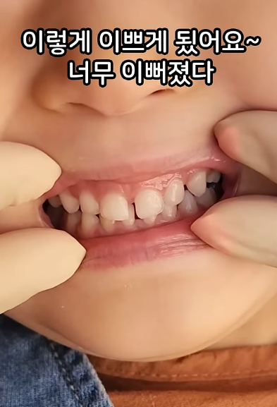 양약수술 예방!