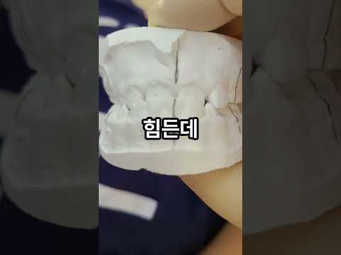 주걱턱, 수술 안 하고 이렇게 바뀝니다